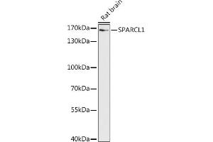 Western blot analysis of extracts of Rat brain, using SP antibody (ABIN7270512) at 1:1000 dilution. (SPARCL1 抗体  (AA 17-300))