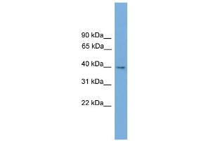 WB Suggested Anti-Tmem130 Antibody Titration:  0. (TMEM130 抗体  (Middle Region))