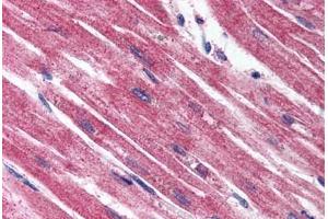 Immunohistochemistry (IHC) image for anti-Endothelin Receptor Type A (EDNRA) (Extracellular Domain) antibody (ABIN1048554)