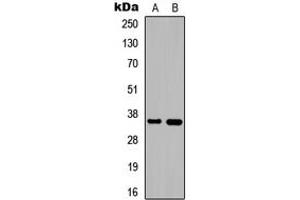Western blot analysis of DNAJB2 expression in HEK293T (A), PC12 (B) whole cell lysates. (DNAJB2 抗体  (C-Term))