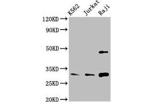 Western Blot Positive WB detected in: K562 whole cell lysate, Jurkat whole cell lysate, Raji whole cell lysate All lanes: CCND3 antibody at 3. (Cyclin D3 抗体  (AA 1-292))
