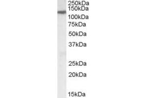 Western Blotting (WB) image for anti-Solute Carrier Family 12 (Potassium-Chloride Transporter) Member 6 (SLC12A6) (AA 375-386) antibody (ABIN962684) (SLC12A6 抗体  (AA 375-386))