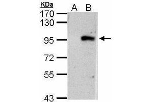 WB Image Western Blot analysis of ECEL1 expression in transfected 293T cell line by ECEL1 polyclonal antibody. (ECEL1 抗体)