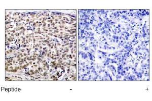 Image no. 1 for anti-cAMP Responsive Element Binding Protein 1 (CREB1) (Ser129) antibody (ABIN197534)