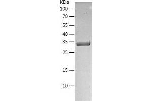 Western Blotting (WB) image for Nth Endonuclease III-Like 1 (NTHL1) (AA 1-312) protein (His tag) (ABIN7286809) (Nth Endonuclease III-Like 1 (NTHL1) (AA 1-312) protein (His tag))