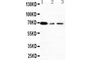 Anti-XRCC1 antibody, Western blotting Lane 1: 293T Cell Lysate Lane 2: A431 Cell Lysate Lane 3: HELA Cell Lysate
