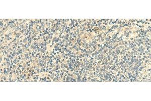 Immunohistochemistry (Paraffin-embedded Sections) (IHC (p)) image for anti-C-Type Lectin Domain Family 10, Member A (CLEC10A) antibody (ABIN7245563)
