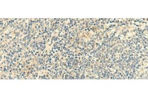 Immunohistochemistry of paraffin-embedded Human tonsil tissue using CLEC10A Polyclonal Antibody at dilution of 1:50(x200) (CLEC10A 抗体)