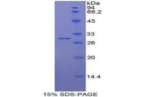 SDS-PAGE analysis of Human Mindbomb Homolog 1 Protein. (MIB1 蛋白)
