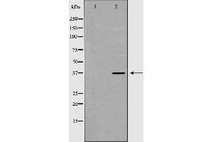 Western blot analysis of extracts of mouse brain line, using DKK3 antibody. (DKK3 抗体)