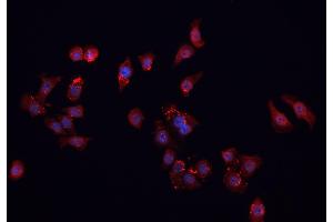 ABIN6266901 staining MCF-7 cells by IF/ICC. (FHIT 抗体  (Internal Region))