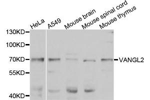 Western blot analysis of extracts of various cell lines, using VANGL2 antibody. (VANGL2 抗体)