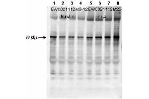 Affinity Purified Phospho-specific antibody to human muscle Glycogen Synthase (GS) at pS640 was used at a 1:1000 dilution to detect human muscle GS by Western blot. (Glycogen Synthase 1 抗体  (pSer641))