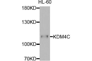 Western blot analysis of extracts of HL-60 cells, using KDM4C antibody. (KDM4C 抗体)