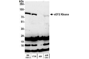 Western Blotting (WB) image for anti-Eukaryotic Elongation Factor-2 Kinase (EEF2K) (AA 675-725) antibody (ABIN7454537)