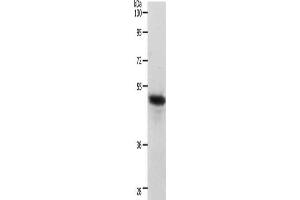 Gel: 10 % SDS-PAGE, Lysate: 40 μg, Lane: Human liver cancer tissue, Primary antibody: ABIN7190220(CERS2 Antibody) at dilution 1/750, Secondary antibody: Goat anti rabbit IgG at 1/8000 dilution, Exposure time: 40 seconds (Ceramide Synthase 2 抗体)