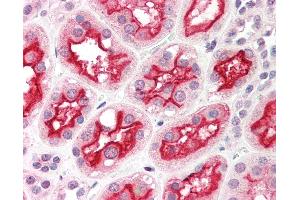 Anti-ACE-2 antibody IHC of human kidney. (ACE2 抗体  (Internal Region))