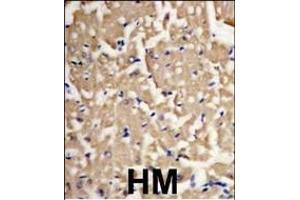 Forlin-fixed and paraffin-embedded heart muscle tissue reacted with Autophagy LC3 G8a (M1LC3A) Antibody (P45) 1801b , which was peroxidase-conjugated to the secondary antibody, followed by DAB staining. (MAP1LC3A 抗体  (AA 30-56))