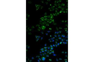 Immunofluorescence analysis of HeLa cells using TRAF3 antibody. (TRAF3 抗体)