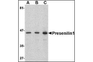 Western blot analysis of presenilin1 in human brain lysate with this product at (A) 0. (Presenilin 1 抗体  (C-Term))