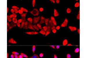 Immunofluorescence analysis of HeLa cells using RPL8 Polyclonal Antibody at dilution of 1:100 (40x lens). (RPL8 抗体)