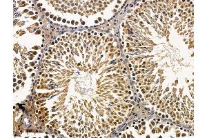 ABIN7096468 and ABIN7100532 at 1/100 staining rat testis tissue by IHC-P. (Znf423 抗体)