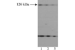 Western Blotting (WB) image for anti-Nuclear Factor of Activated T-Cells, Cytoplasmic, Calcineurin-Dependent 2 (NFAT1) (AA 433-567) antibody (ABIN967558) (NFAT1 抗体  (AA 433-567))