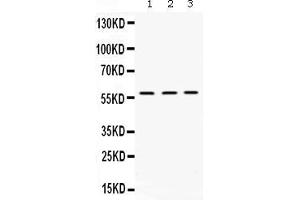 Western blot analysis of XIAP expression in rat kidney extract ( Lane 1), mouse liver extract ( Lane 2) and HELA whole cell lysates ( Lane 3). (XIAP 抗体  (AA 15-244))