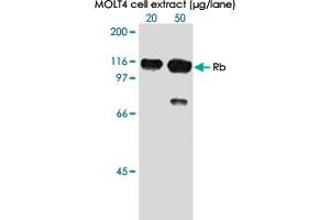 Western blot analysis of in extracts from MOLT 4 cell using RB1 (phospho S807) monoclonal antibody, clone 5H12 . (Retinoblastoma 1 抗体  (pSer807))