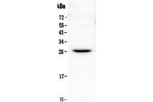 Western blot analysis of Flt3 ligand using anti-Flt3 ligand antibody . (FLT3LG 抗体  (AA 28-189))