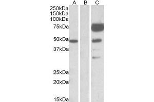 HEK293 lysate (10ug protein in RIPA buffer) overexpressing Human ANGPT1 with DYKDDDDK tag probed with ABIN2561113 (1ug/ml) in Lane A and probed with anti- DYKDDDDK Tag (1/1000) in lane C. (Angiopoietin 1 抗体  (Internal Region))