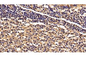 Detection of IL2Rg in Human Appendix Tissue using Polyclonal Antibody to Interleukin 2 Receptor Gamma (IL2Rg) (IL2RG 抗体  (AA 23-262))