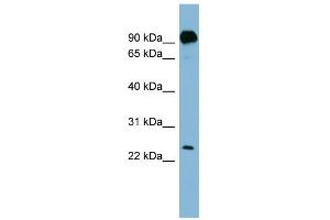 WB Suggested Anti-PRRG1 Antibody Titration:  0. (PRRG1 抗体  (N-Term))