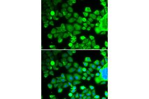 Immunofluorescence analysis of MCF-7 cells using RPS10 antibody (ABIN1877083). (RPS10 抗体)