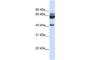 PARD6B antibody used at 1 ug/ml to detect target protein. (PARD6B 抗体)