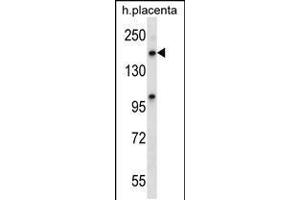 Western blot analysis in human placenta tissue lysates (35ug/lane). (XPO5 抗体  (C-Term))