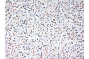 Immunohistochemical staining of paraffin-embedded lung tissue using anti-USP13mouse monoclonal antibody. (USP13 抗体)