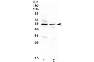 Western blot testing of human 1) A431 and 2) PANC-1 cell lysate with VIPR1 antibody. (VIPR1 抗体)