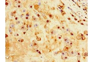 Immunohistochemistry of paraffin-embedded human placenta tissue using ABIN7156880 at dilution of 1:100 (EBI3 抗体  (AA 21-227))