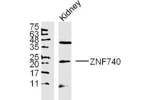 ZNF740 lysates probed with Polyclonal Antibody, unconjugated  at 1:300 overnight at 4°C followed by a conjugated secondary antibody at 1:10000 for 90 minutes at 37°C. (ZNF740 抗体  (AA 101-193))