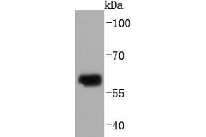 Human skin ysates probed with Collagen X (1H8) Monoclonal Antibody  at 1:1000 overnight at 4˚C. (COL10 抗体)
