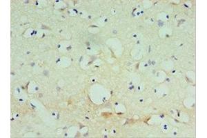 Immunohistochemistry of paraffin-embedded human brain tissue using ABIN7170476 at dilution of 1:100 (SPAG16 抗体  (AA 1-183))