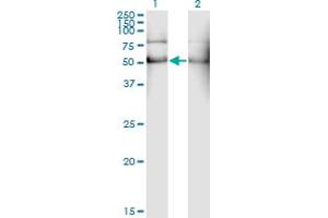 Western Blot analysis of ALDH2 expression in transfected 293T cell line by ALDH2 monoclonal antibody (M01), clone 1E5. (ALDH2 抗体  (AA 408-517))
