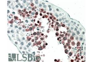 ABIN238571 (5µg/ml) staining of paraffin embedded Human Testis. (MEPCE 抗体  (Internal Region))