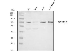 Western blot analysis of TREML2 using anti-TREML2 antibody (ABIN7602217).