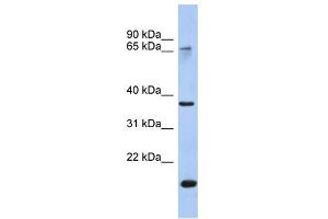 WB Suggested Anti-ANXA10 Antibody Titration:  0. (Annexin a10 抗体  (Middle Region))