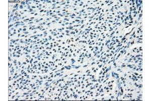 Immunohistochemical staining of paraffin-embedded endometrium tissue using anti-SLC2A5mouse monoclonal antibody. (SLC2A5 抗体)