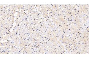 Detection of IRAK4 in Human Cardiac Muscle Tissue using Polyclonal Antibody to Interleukin 1 Receptor Associated Kinase 4 (IRAK4) (IRAK4 抗体  (AA 189-427))