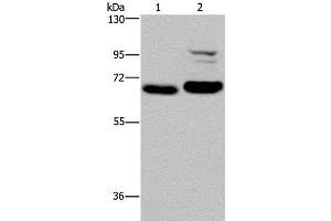Western Blot analysis of K562 and NIH/3T3 cell using OS9 Polyclonal Antibody at dilution of 1:200 (OS9 抗体)