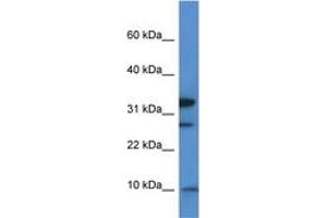 Image no. 1 for anti-Mitochondrial Ribosomal Protein S33 (MRPS33) (AA 50-99) antibody (ABIN6746526)